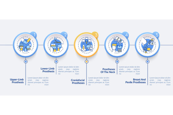 Implants Types Vector Infographic Design Guide